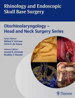 Buchcover Rhinology and Endoscopic Skull Base Surgery  | EAN 9789382076018 | ISBN 93-82076-01-8 | ISBN 978-93-82076-01-8