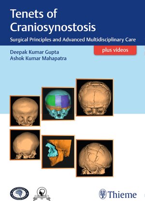 Buchcover Tenets of Craniosynostosis | EAN 9789386293565 | ISBN 93-86293-56-0 | ISBN 978-93-86293-56-5