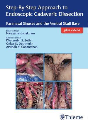 Buchcover Step-By-Step Approach to Endoscopic Cadaveric Dissection, ed 1 | EAN 9789388257060 | ISBN 93-88257-06-5 | ISBN 978-93-88257-06-0