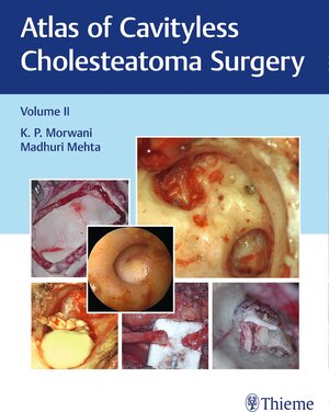 Buchcover Atlas of Cavityless Cholesteatoma Surgery, Vol 2 | K Morwani | EAN 9789388257190 | ISBN 93-88257-19-7 | ISBN 978-93-88257-19-0