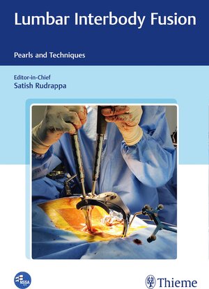 Buchcover Lumbar Interbody Fusion  | EAN 9789388257541 | ISBN 93-88257-54-5 | ISBN 978-93-88257-54-1
