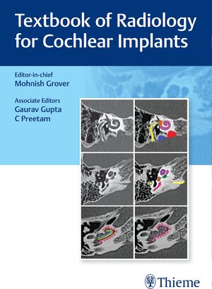 Buchcover Textbook of Radiology for Cochlear Implants  | EAN 9789392819292 | ISBN 93-92819-29-3 | ISBN 978-93-92819-29-2