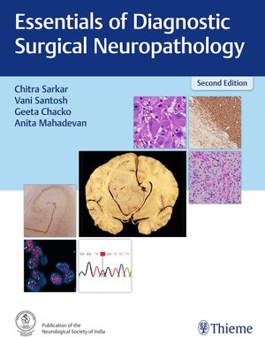 Buchcover Essentials of Diagnostic Surgical Neuropathology  | EAN 9789395390057 | ISBN 93-953900-5-0 | ISBN 978-93-953900-5-7