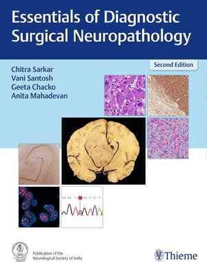 Buchcover Essentials of Diagnostic Surgical Neuropathology  | EAN 9789395390088 | ISBN 93-953900-8-5 | ISBN 978-93-953900-8-8