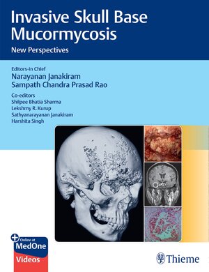 Buchcover Invasive Skull Base Mucormycosis  | EAN 9789395390354 | ISBN 93-953903-5-2 | ISBN 978-93-953903-5-4