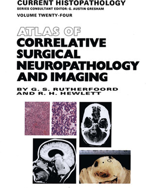 Buchcover Atlas of Correlative Surgical Neuropathology and Imaging | G.S. Rutherfoord | EAN 9789401046282 | ISBN 94-010-4628-X | ISBN 978-94-010-4628-2