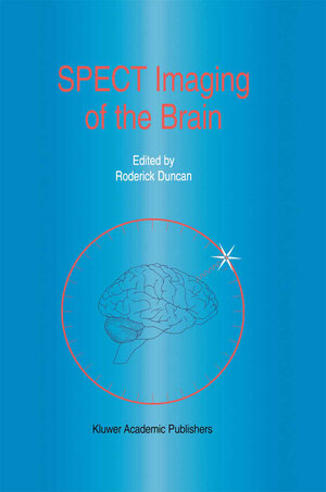 Buchcover SPECT Imaging of the Brain | EAN 9789401062718 | ISBN 94-010-6271-4 | ISBN 978-94-010-6271-8