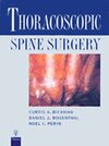 Buchcover Thoracoscopic Spine Surgery