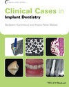 Buchcover Clinical Cases in Implant Dentistry