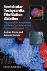 Buchcover Ventricular Tachycardia / Fibrillation Ablation