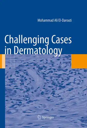 Buchcover ISBN 9781447171997