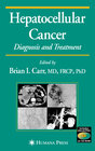 Buchcover Hepatocellular Carcinoma