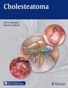 Buchcover Cholesteatoma