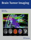 Buchcover Brain Tumor Imaging
