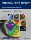 Buchcover Intraocular Lens Surgery