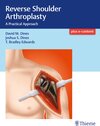 Buchcover Reverse Shoulder Arthroplasty