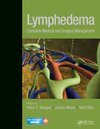 Buchcover Lymphedema
