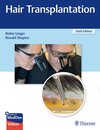 Buchcover Hair Transplantation