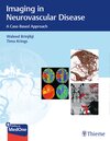 Buchcover Imaging in Neurovascular Disease
