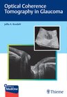 Buchcover Optical Coherence Tomography in Glaucoma