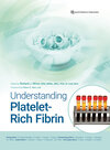 Buchcover Understanding Platelet‑Rich Fibrin