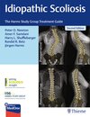 Buchcover Idiopathic Scoliosis