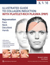 Buchcover Illustrated Guide to Collagen Induction with Platelet-Rich Plasma (PRP)