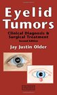 Buchcover Eyelid Tumors: Clinical Diagnosis and Surgical Treatment