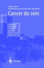 Buchcover Cancer du sein