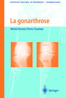 Buchcover La gonarthrose