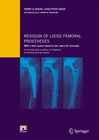 Buchcover Revision of loose femoral prostheses with a stem system based on the "press-fit" principle