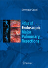 Buchcover Atlas of endoscopic major pulmonary resections