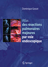 Buchcover Atlas des résections pulmonaires majeures par voie endoscopique