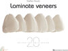 Buchcover Laminate Veneers