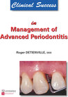 Buchcover Clinical Success in Management of Advanced Periodontitis