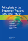 Buchcover Arthroplasty for the Treatment of Fractures in the Older Patient