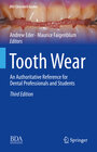 Buchcover Tooth Wear