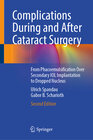 Buchcover Complications During and After Cataract Surgery