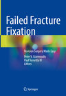 Buchcover Failed Fracture Fixation