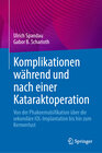 Buchcover Komplikationen während und nach einer Kataraktoperation