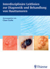 Buchcover Interdisziplinäre Leitlinien zu Diagnostik und Behandlung von Hauttumoren