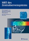 Buchcover MRT des Zentralnervensystems