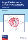 Buchcover Surgical Techniques in Moyamoya Vasculopathy