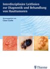 Buchcover Interdisziplinäre Leitlinien zur Diagnostik und Behandlung von Hauttumoren
