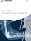 Buchcover Periprosthetic Fracture Management