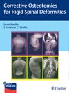 Buchcover Corrective Osteotomies for Rigid Spinal Deformities