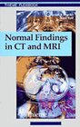 Buchcover Normal Findings in CT and MRI