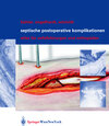 Buchcover Septische postoperative Komplikationen