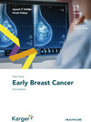 Buchcover Fast Facts: Early Breast Cancer
