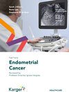 Buchcover Fast Facts: Endometrial Cancer